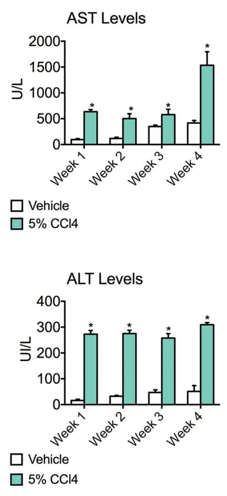 AST levels and ALT levels